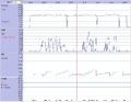 Thumbnail for version as of 16:17, 22 November 2009